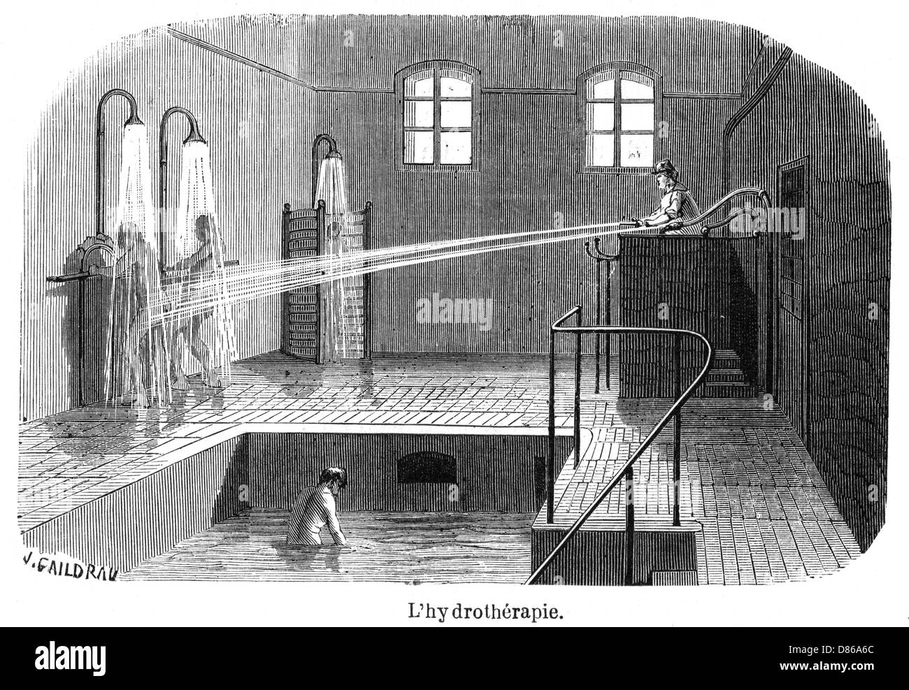 Hydrotherapy Treatment At French Mental Hospital Stock Photo Alamy