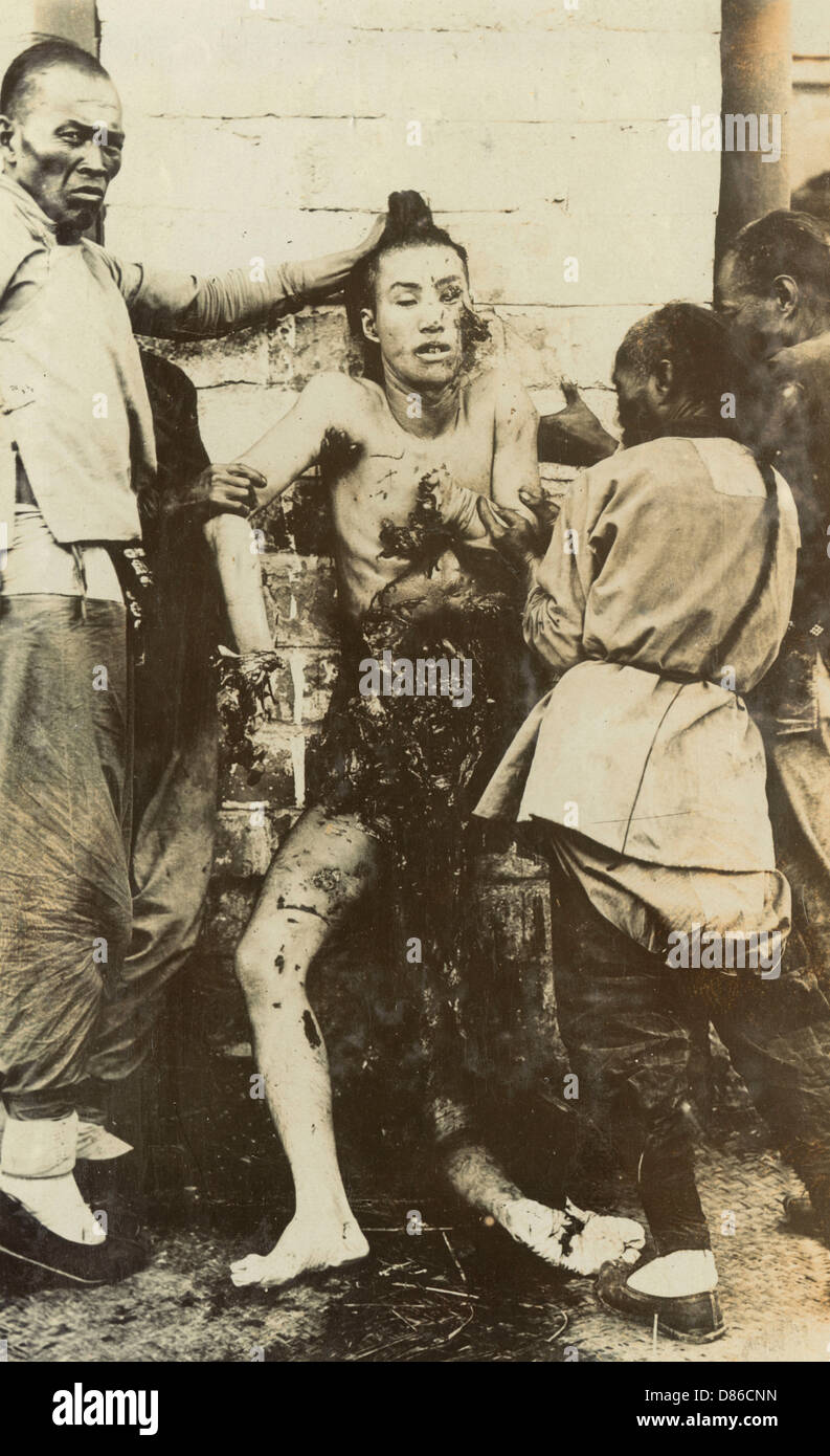 The Validity Of Torture