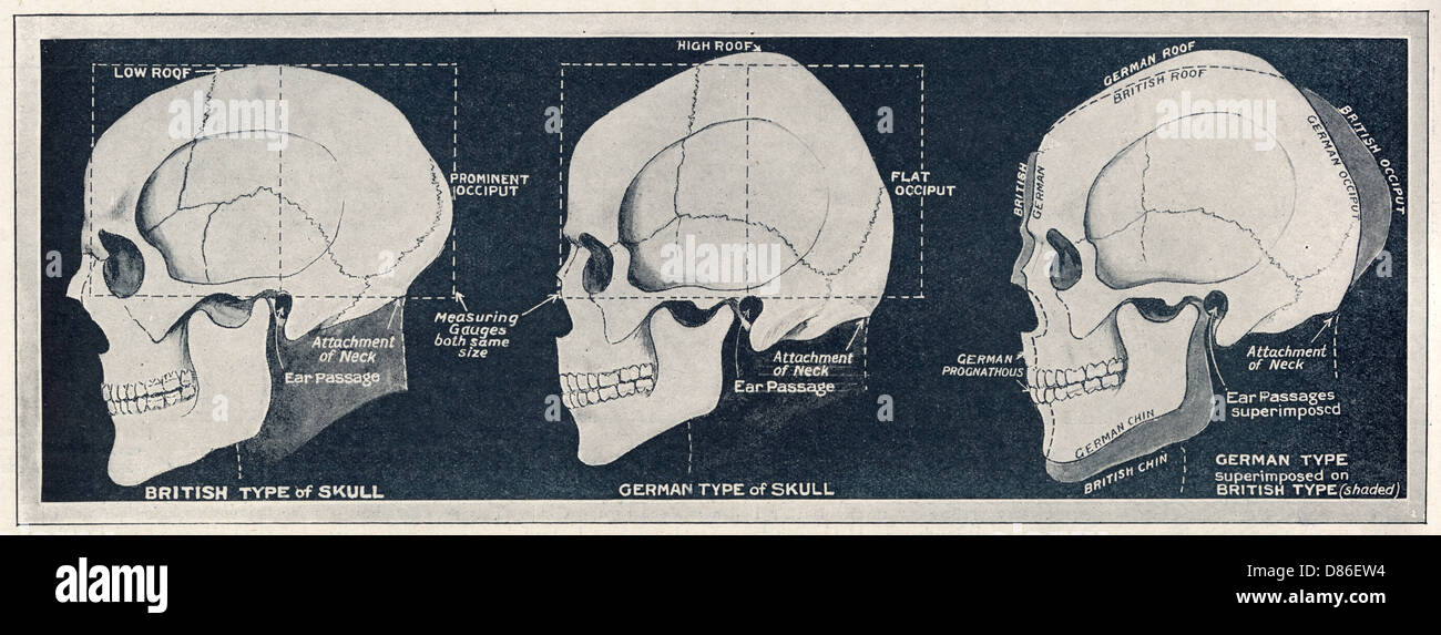 Comparison of British & German skull shapes, WW1 Stock Photo