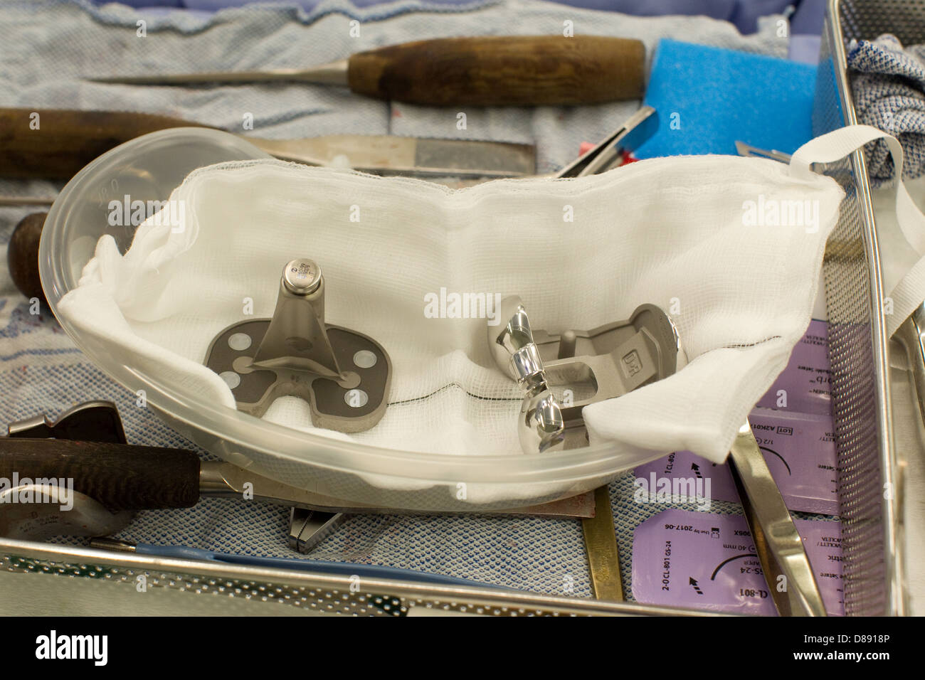 Total Knee Replacement Operation In A Hospital Theatre Stock Photo Alamy Total knee replacement operation in a hospital theatre stock photo alamy