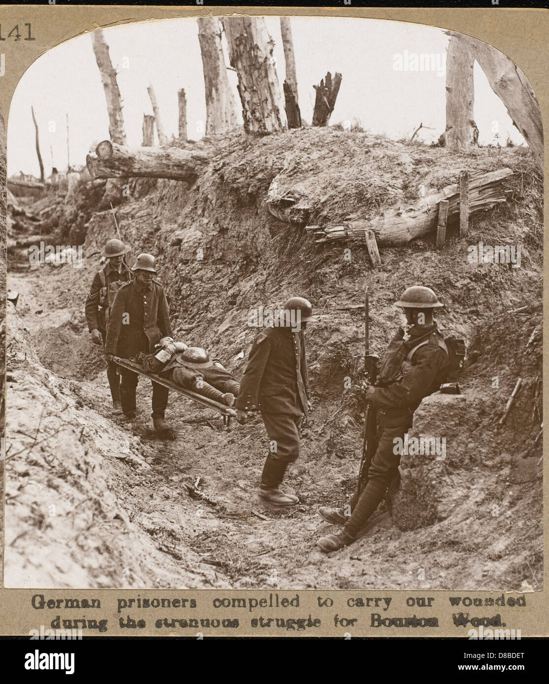 First World War Wounded Stock Photo: 56800432 - Alamy