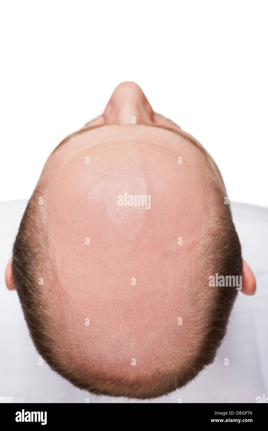 Bald man head Stock Photo