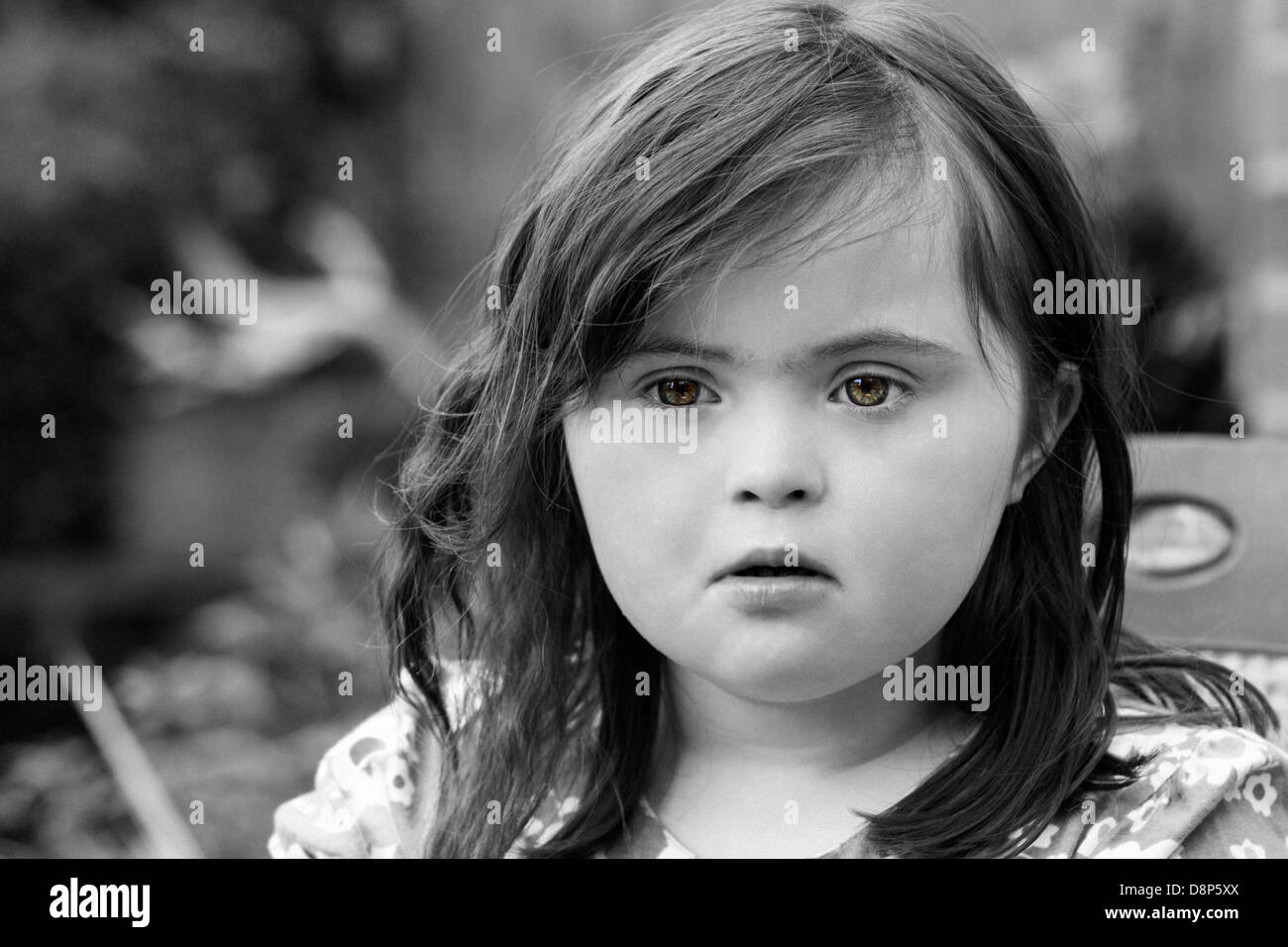 Young Girl with Downs Syndrome. Stock Photo