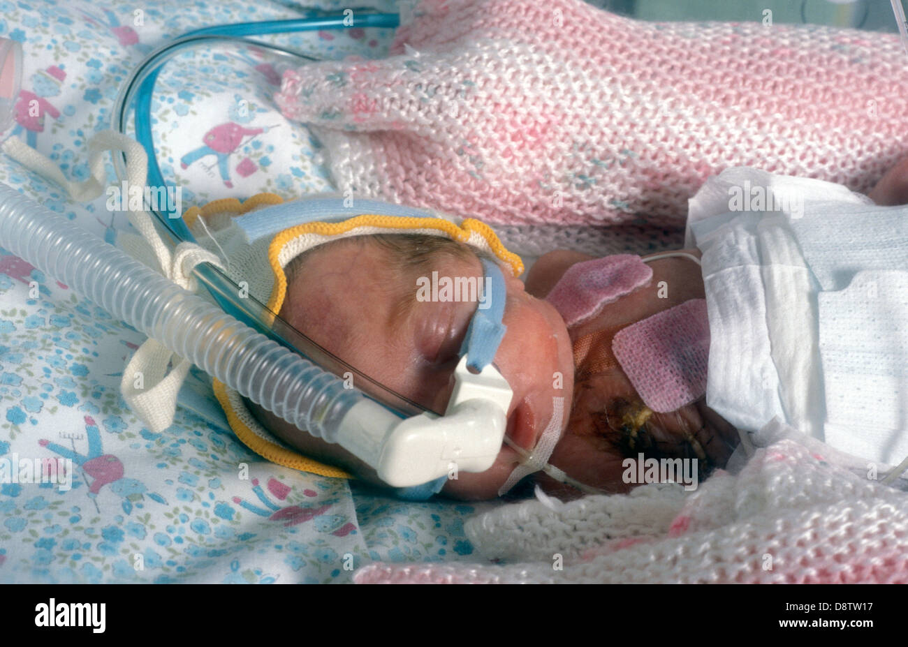 tiny premature baby in incubator attached to apparatus Stock Photo Alamy