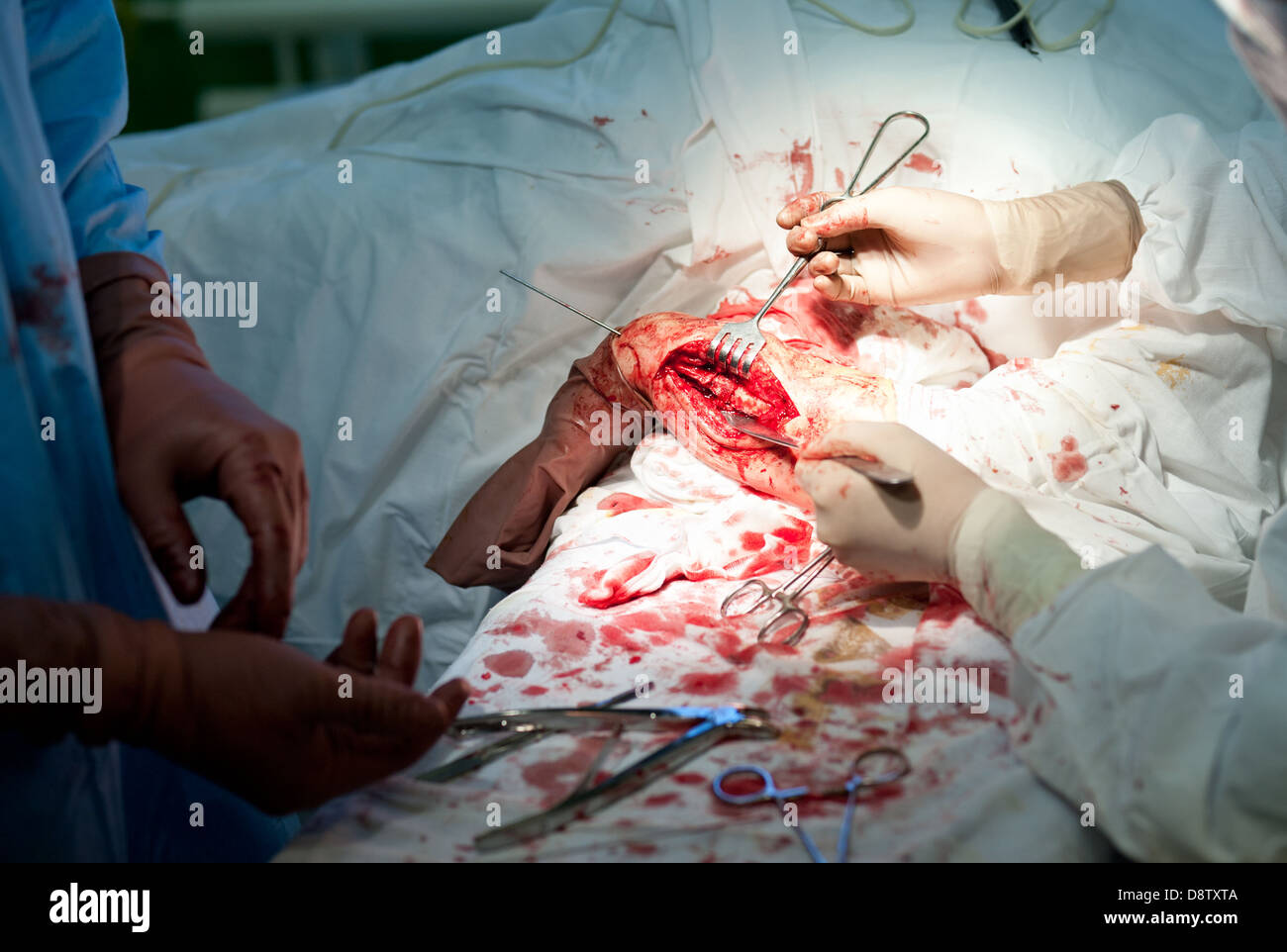 surgical operation Stock Photo