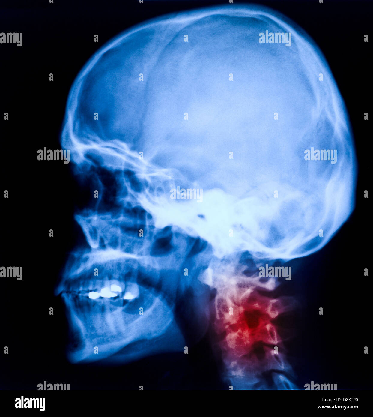 Xray image hires stock photography and images Alamy