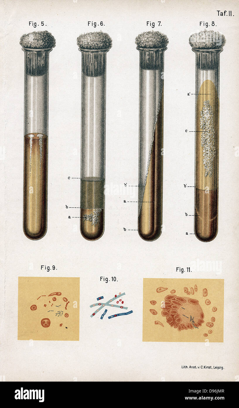 5:Pneumonia culture. 6 Albumen from rotten egg. 7& 8:Tuberculosis as prepared by Koch. 9:Sputum from TB patient. 10: Anthrax bacillus. 11:TB bacillus stained blue. From Ferdinand Hueppe 'Die die Methoden der Backtierien-Forschung', Wiesbaden, 1889. Hueppe worked with Koch. Stock Photo