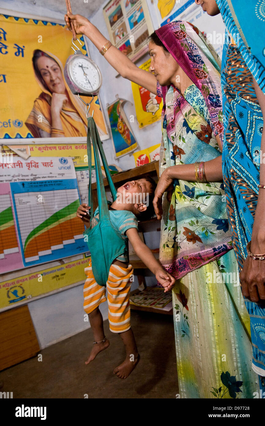 Tackling child malnutrition, Shivpuri District Hospital, Madhya Pradesh, India - Feb 2010.A child is weighed in a spring balance Stock Photo