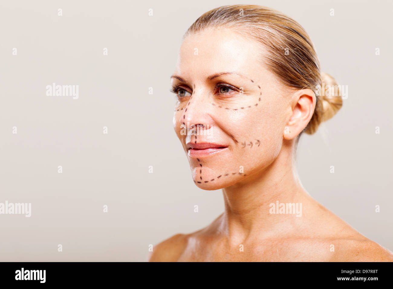 middle aged woman getting ready for plastic surgery Stock Photo