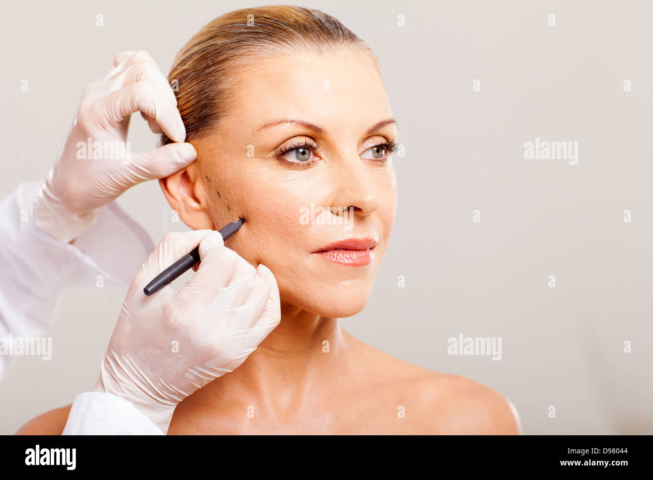 cosmetic surgeon drawing lines on senior woman face for plastic surgery