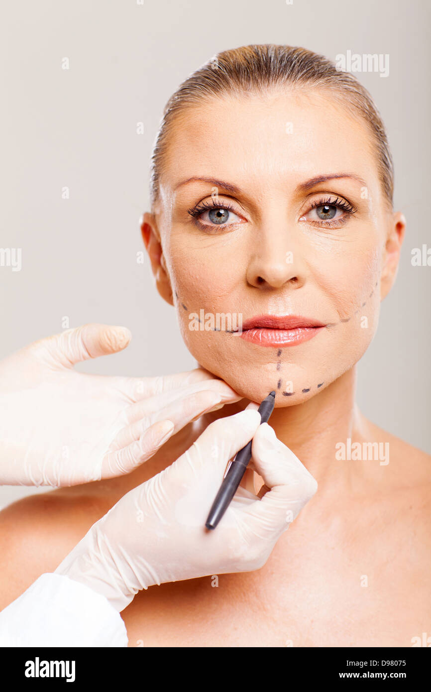 older woman with correcting lines before cosmetic surgery Stock Photo