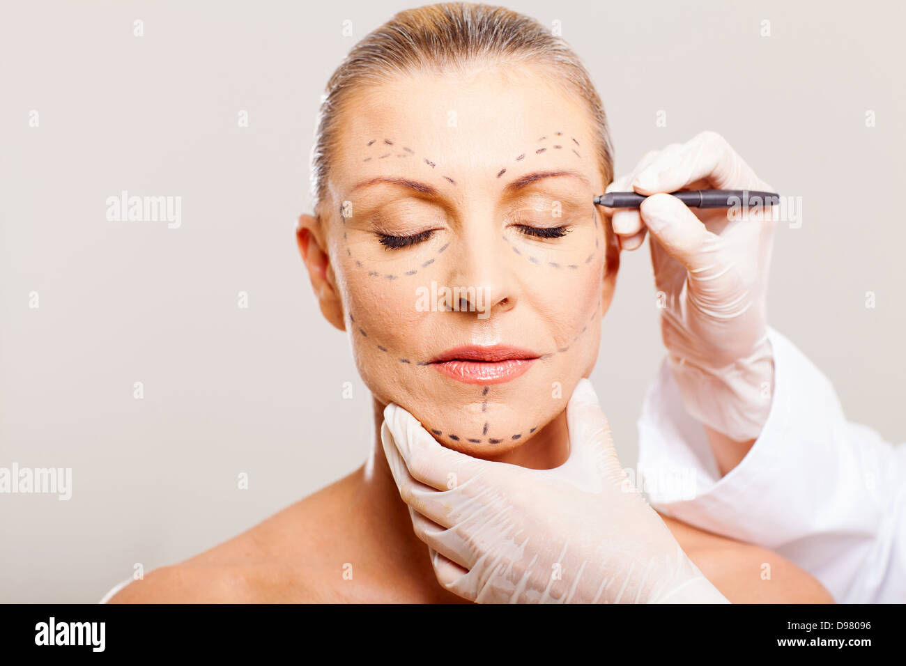 middle aged woman with correction lines before cosmetic surgery Stock Photo