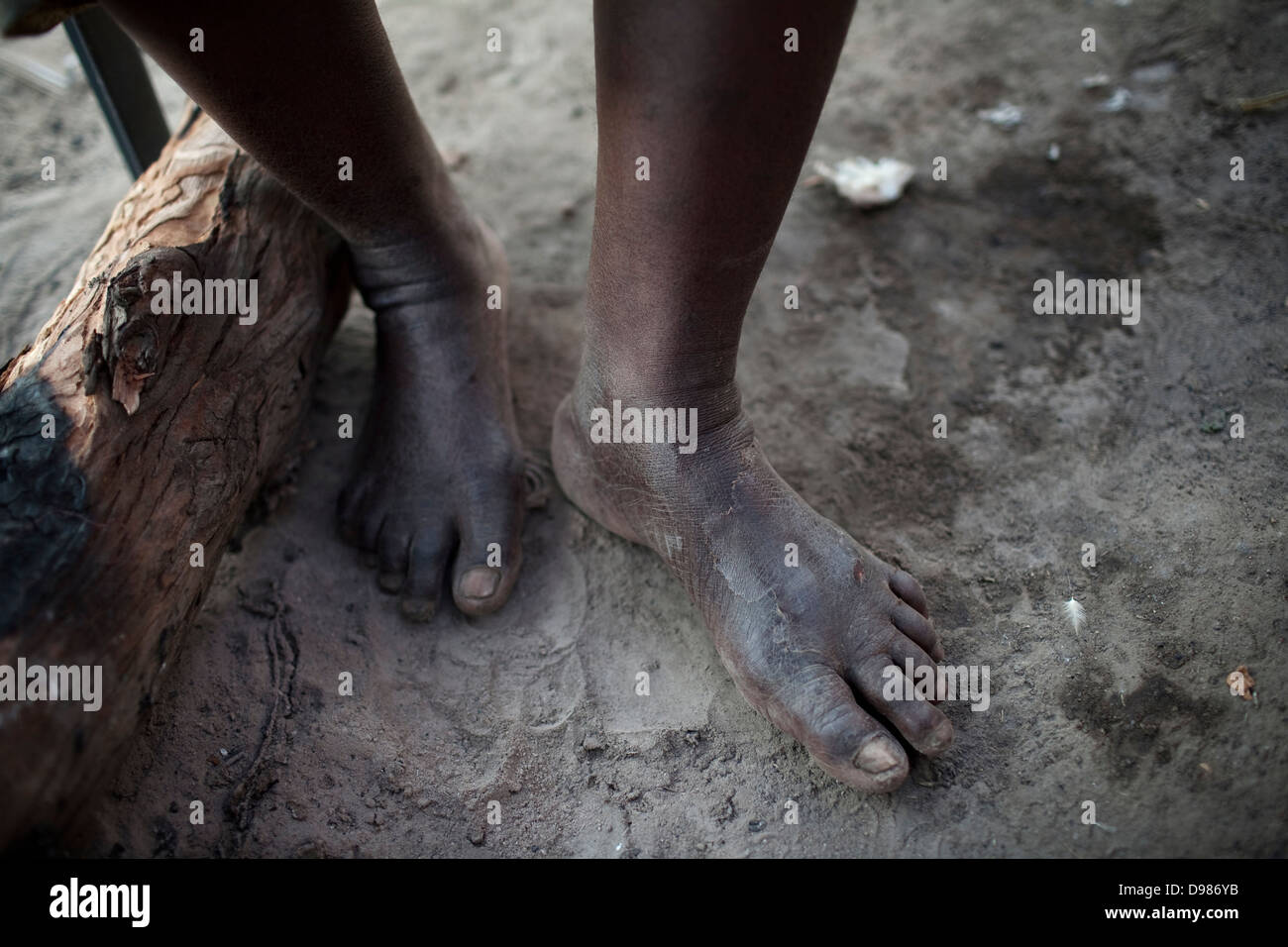 Fifty-seven-year-old Esther Khoza's feet Esther lives in mud shack without electricity running water or toilet in shadow Stock Photo