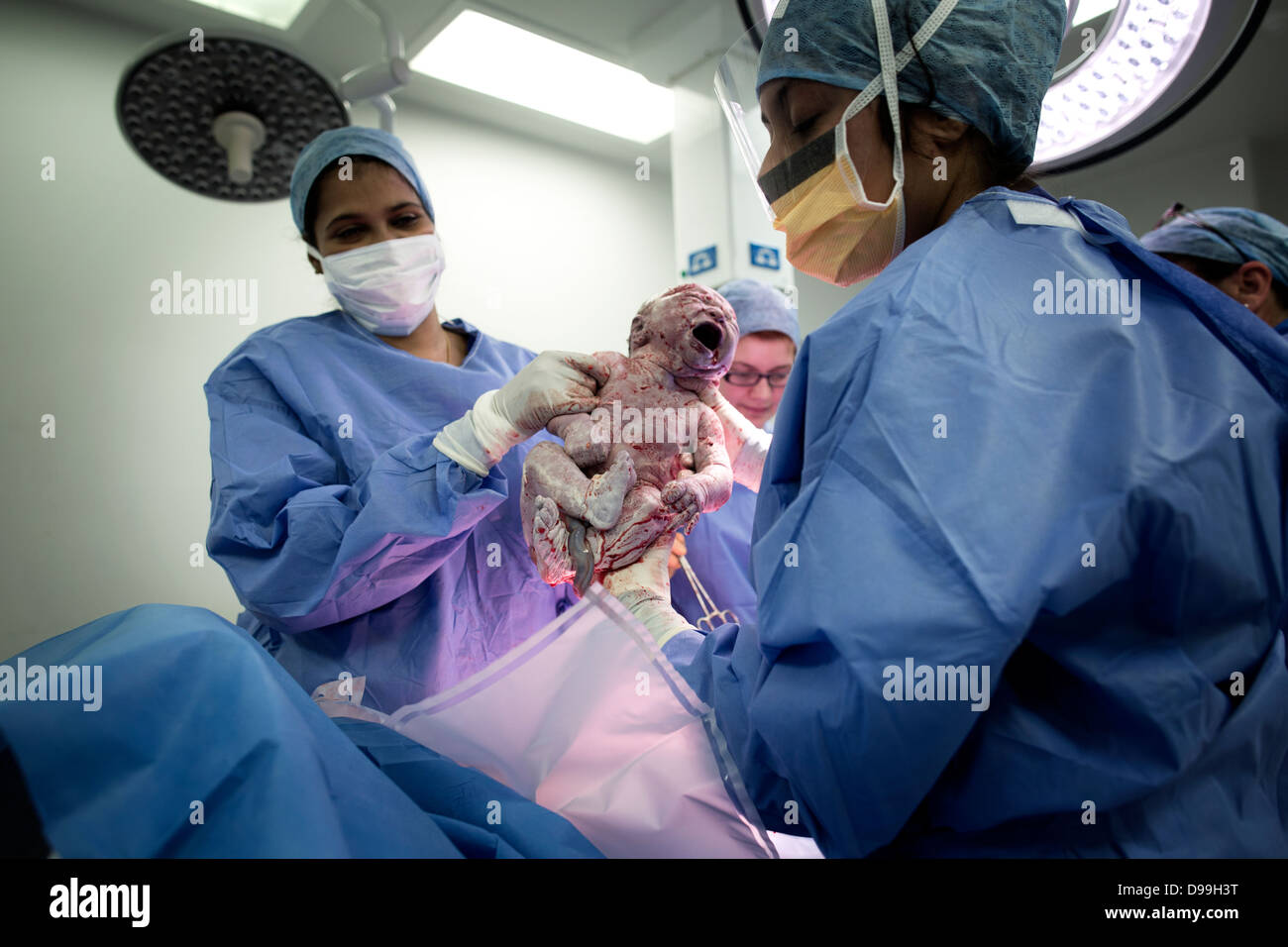 A newborn bady takes his first breath at Stepping Hill Hospital Stockport UK, the baby boy was born by a C section operation Stock Photo