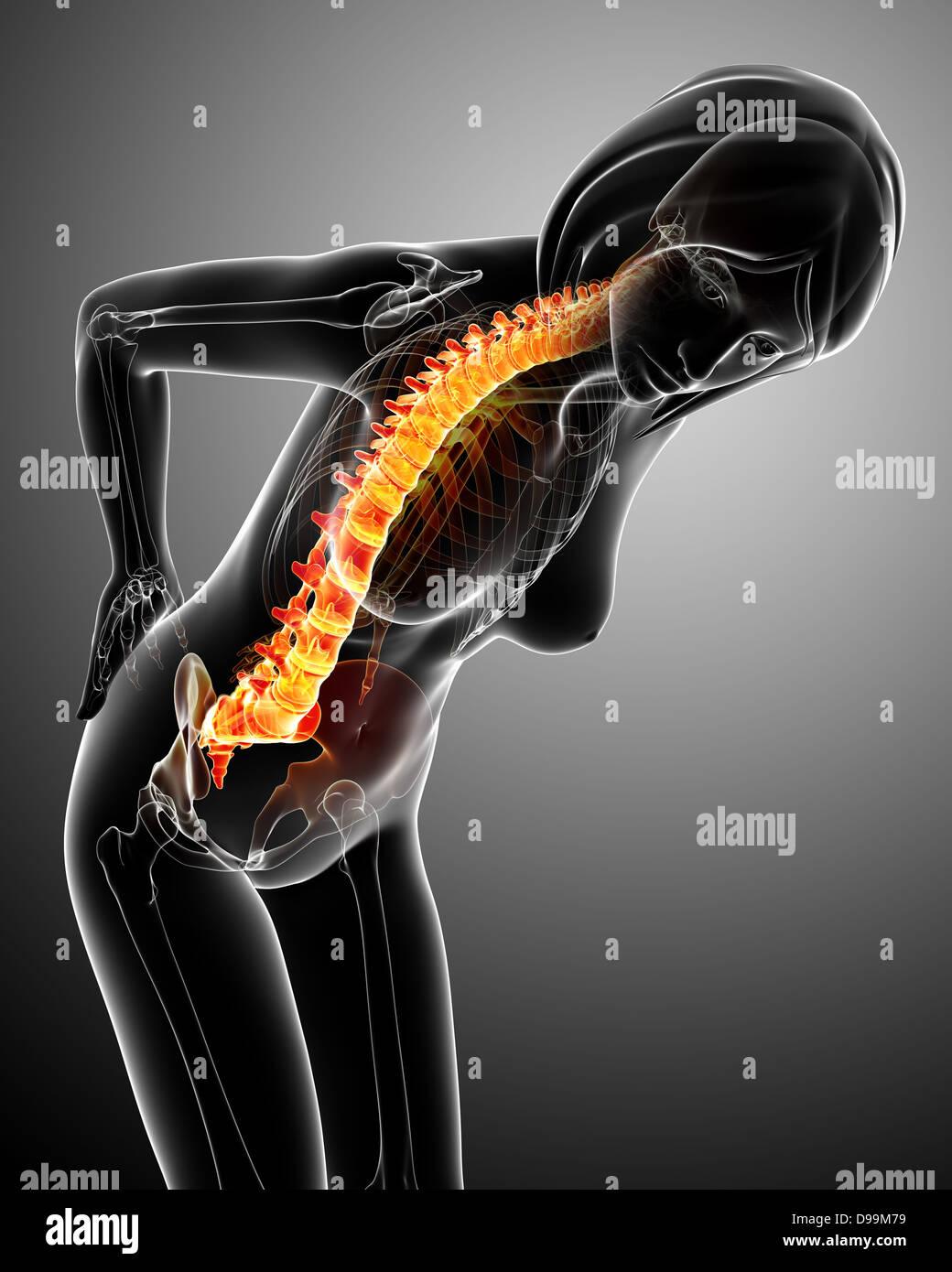 Human back pain anatomy Stock Photo Alamy