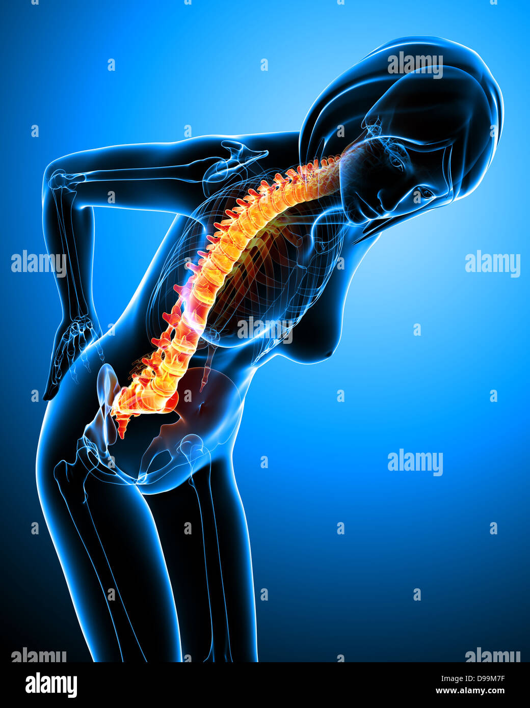 Human back pain anatomy Stock Photo Alamy