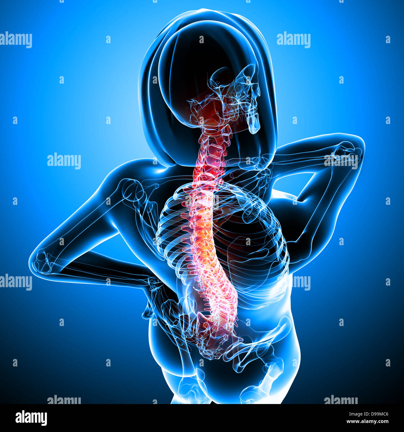 Human back pain anatomy Stock Photo Alamy