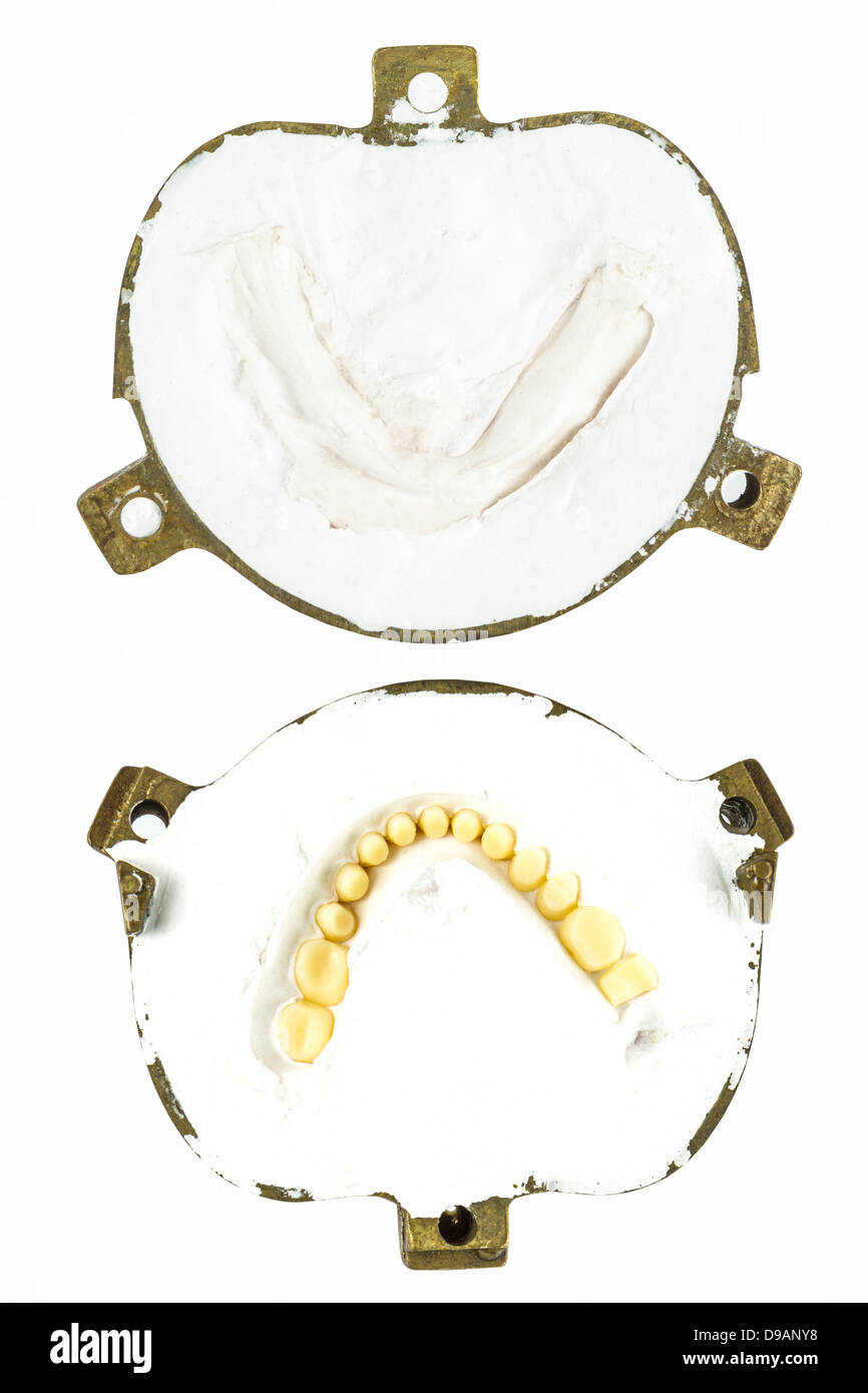 make denture plaster model isolate Stock Photo Alamy
