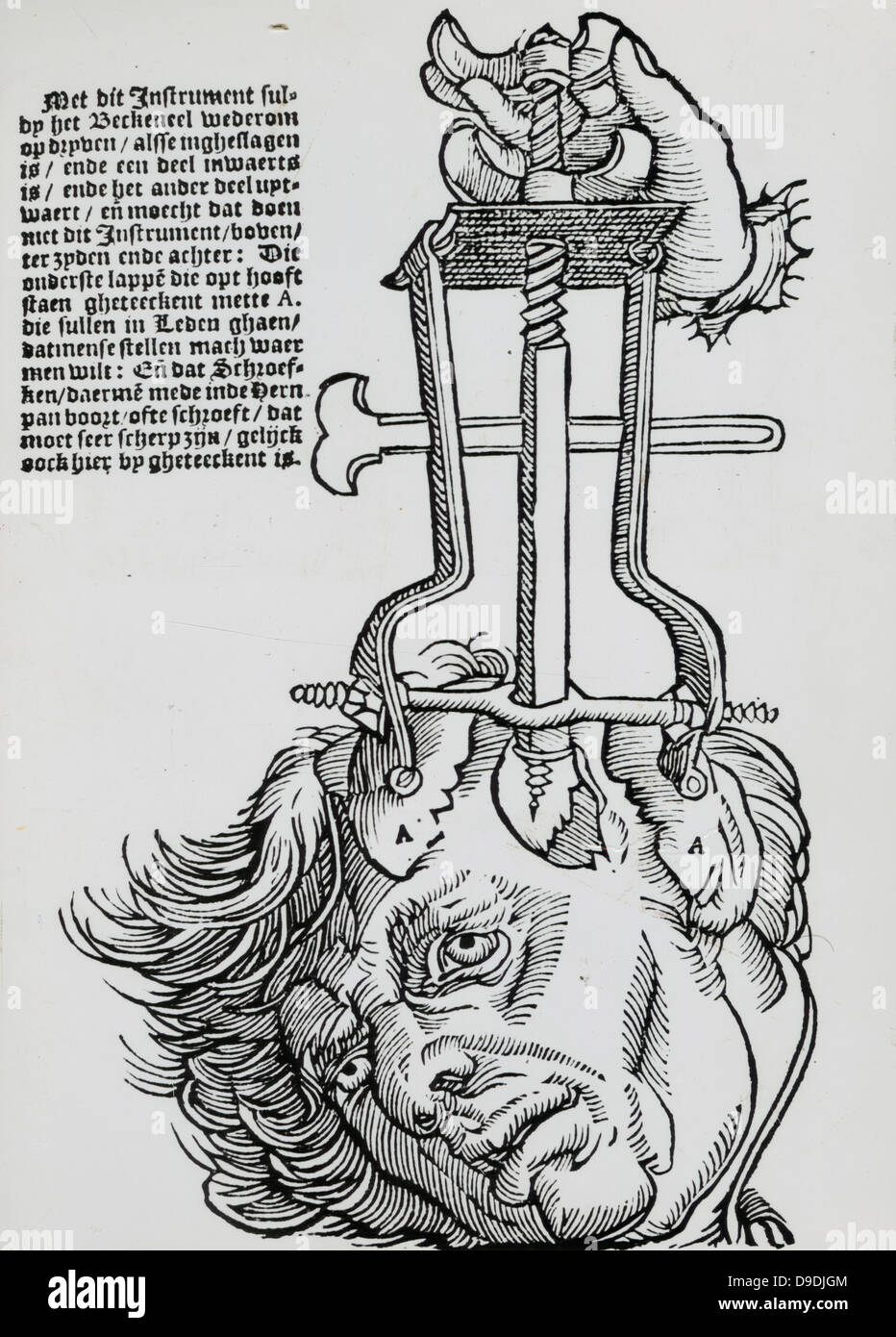 Trephination: elevator for removing fragments of broken skull. Woodcut from a book on field surgery, 1593. Stock Photo