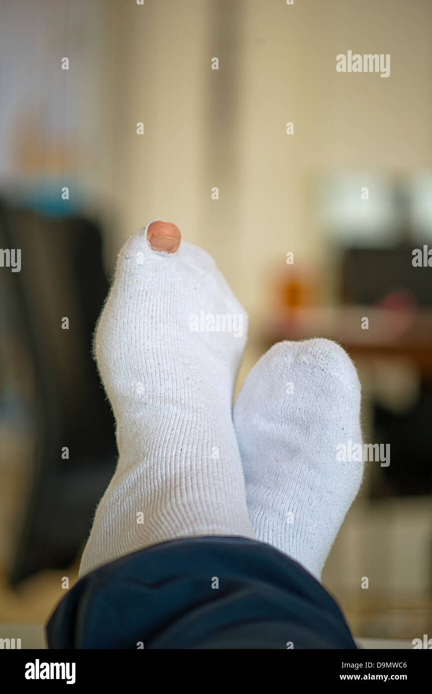 Hole in the sock Stock Photo Alamy