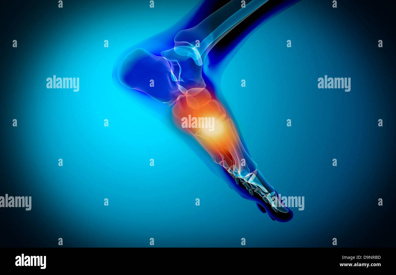 Conceptual image of pain in human foot. Stock Photo