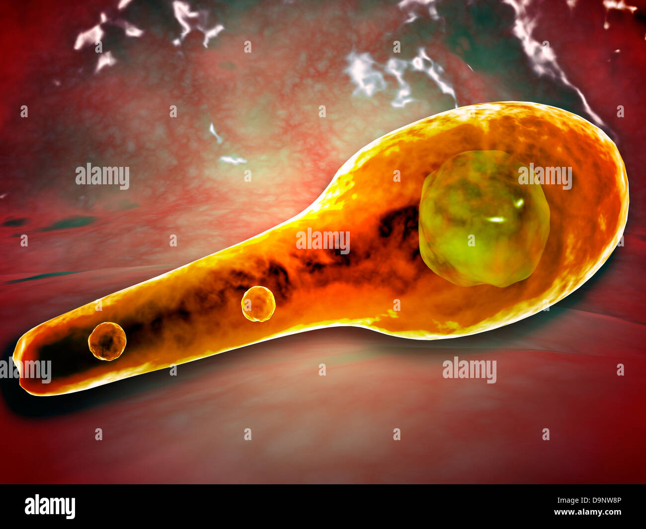 Microscopic view of Tetanus Stock Photo - Alamy