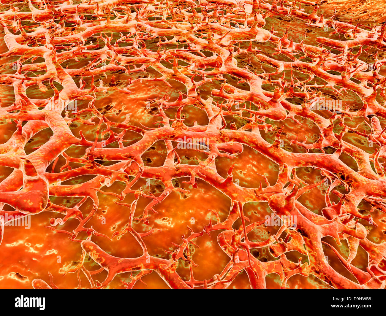 Tinea pedis (athlete’s foot) hires stock photography and images Alamy