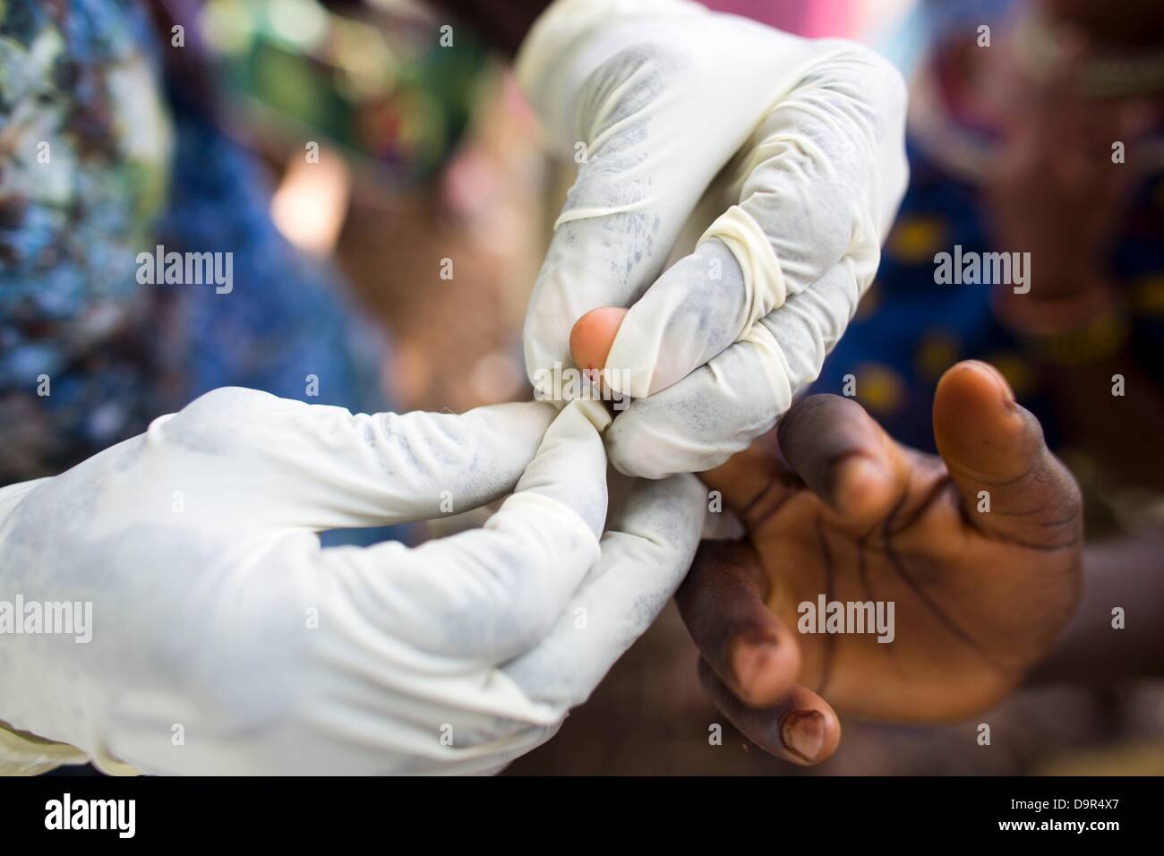 MSF mobile clinic in Central African Republic treating people from malaria Stock Photo