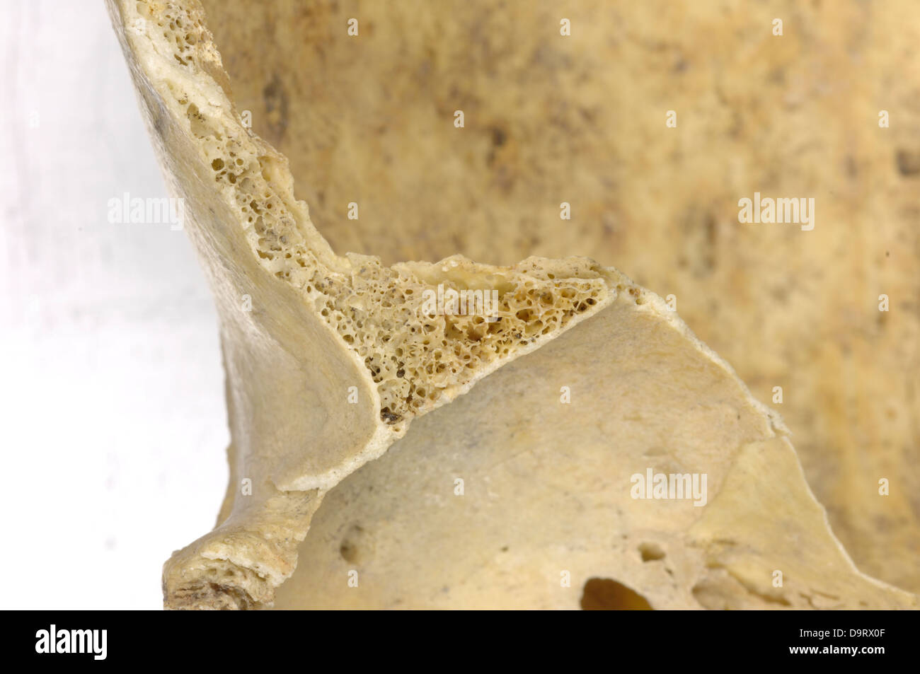 Cross section of bone Stock Photo: 57688303 - Alamy