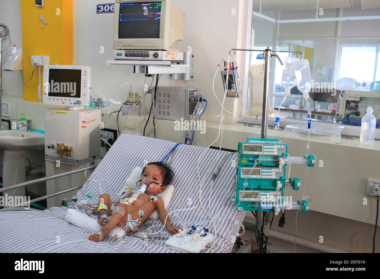 Nov 26, 2012 Bangalore, Karnataka, India The ICU Pediatric Ward at