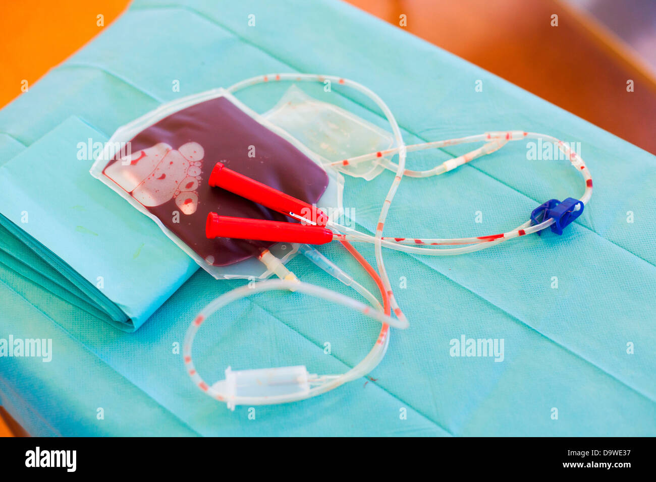 Umbilical cord blood stem cell harvesting Bag placental blood Obstetrics and gynaecology department Limoges hospital France. Stock Photo