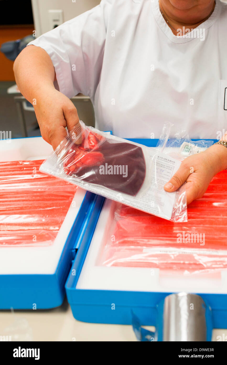 Umbilical cord blood stem cell harvesting Bag placental blood Obstetrics and gynaecology department Limoges hospital France. Stock Photo