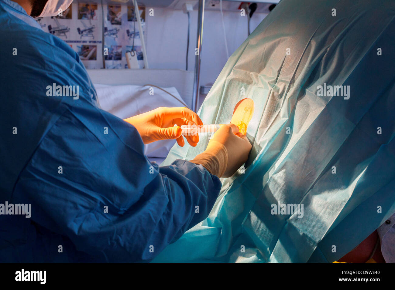 Pregnant woman getting epidural anaesthetic injection prior to delivery