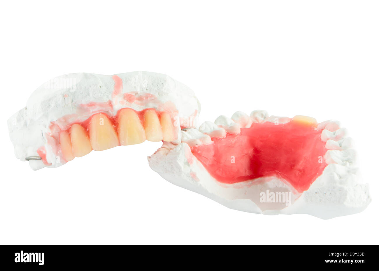 Denture teeth with wax model isolate on white background Stock Photo