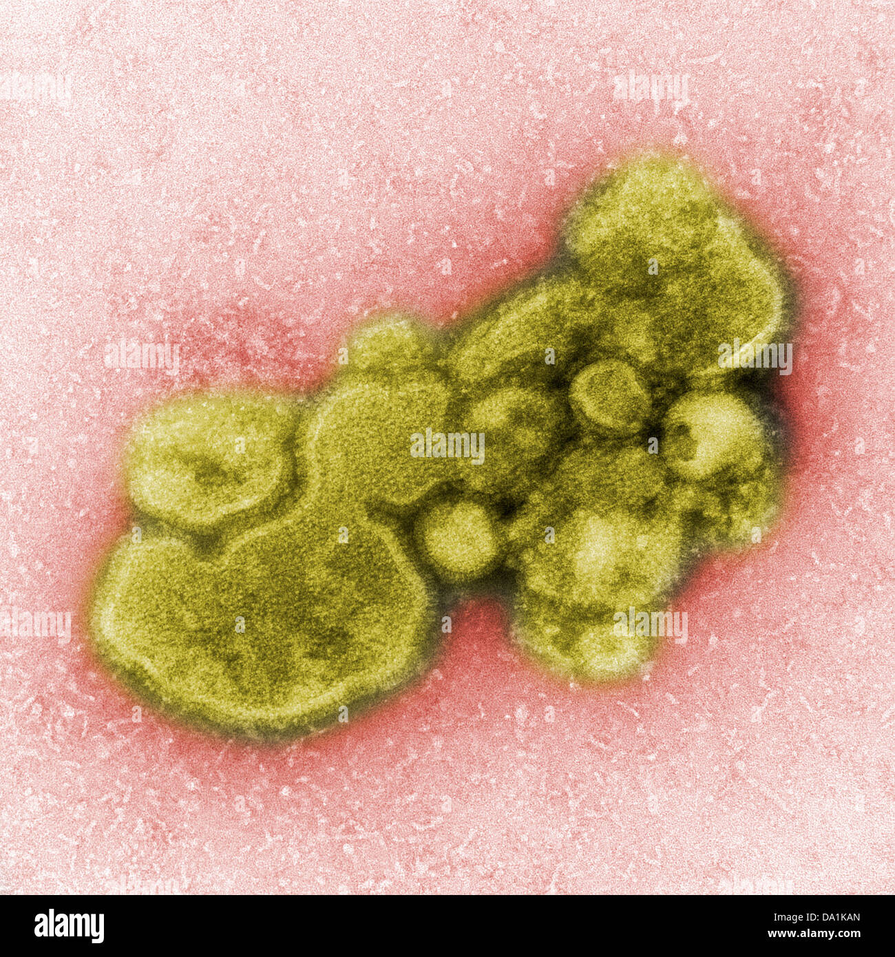Avian influenza micrograph hi-res stock photography and images - Alamy