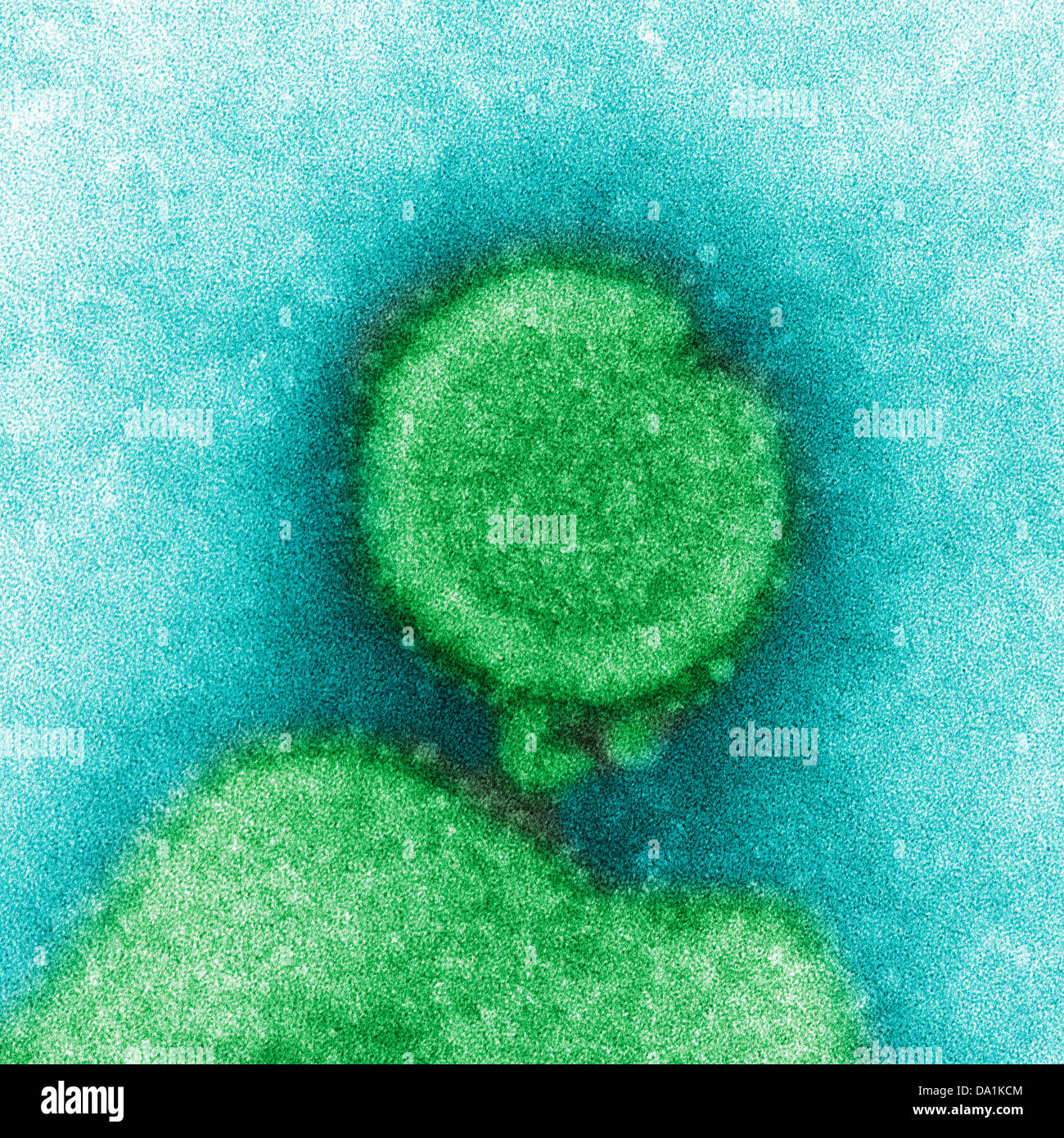 Avian influenza micrograph hi-res stock photography and images - Alamy