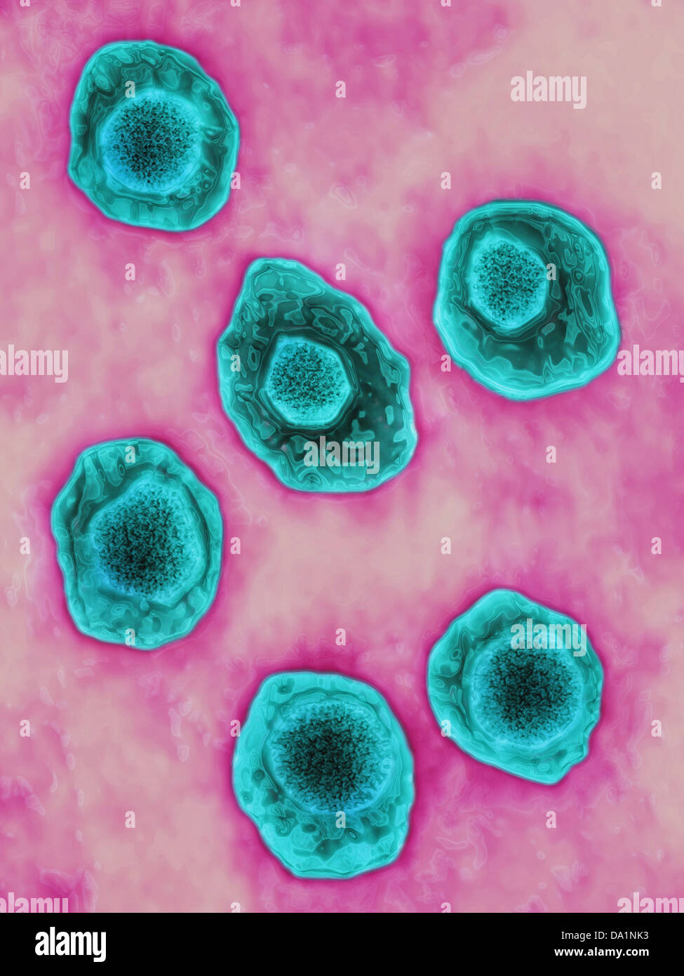 Epstein Barr Virus Hi-res Stock Photography And Images - Alamy