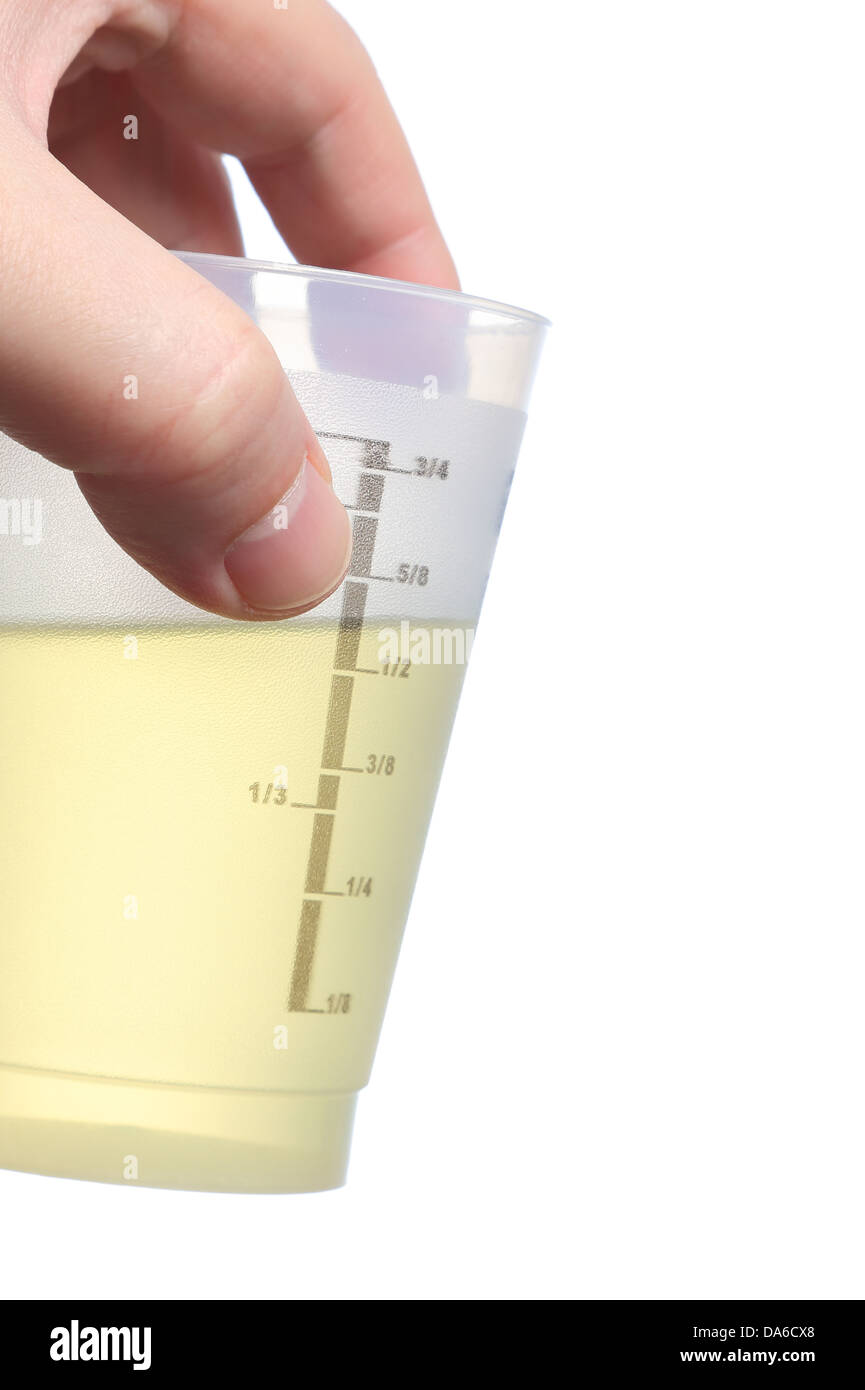 Holding urine sample Stock Photo Alamy
