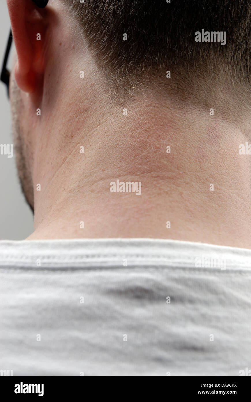 Neck of a man Stock Photo