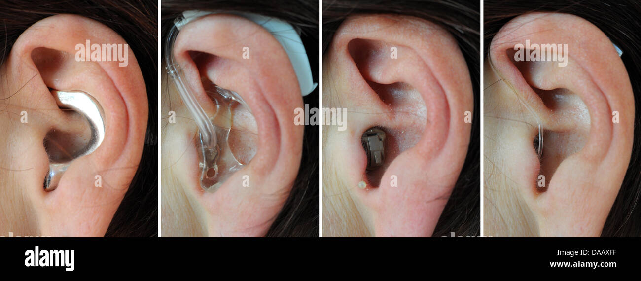 The illustration shows various editions of hearing aid devices attached