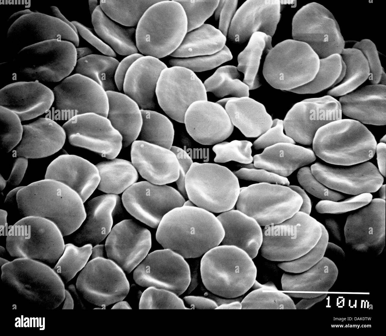 HANDOUT - An undated scanning electron microscope handout picture from the Max Planck Institute for Molecular Biomedicine shows human blood in Muenster, Germany. Numerous scientists at the institute of the University of Muenster are involved in stem cell research. Photo: Mpi Muenster Stock Photo