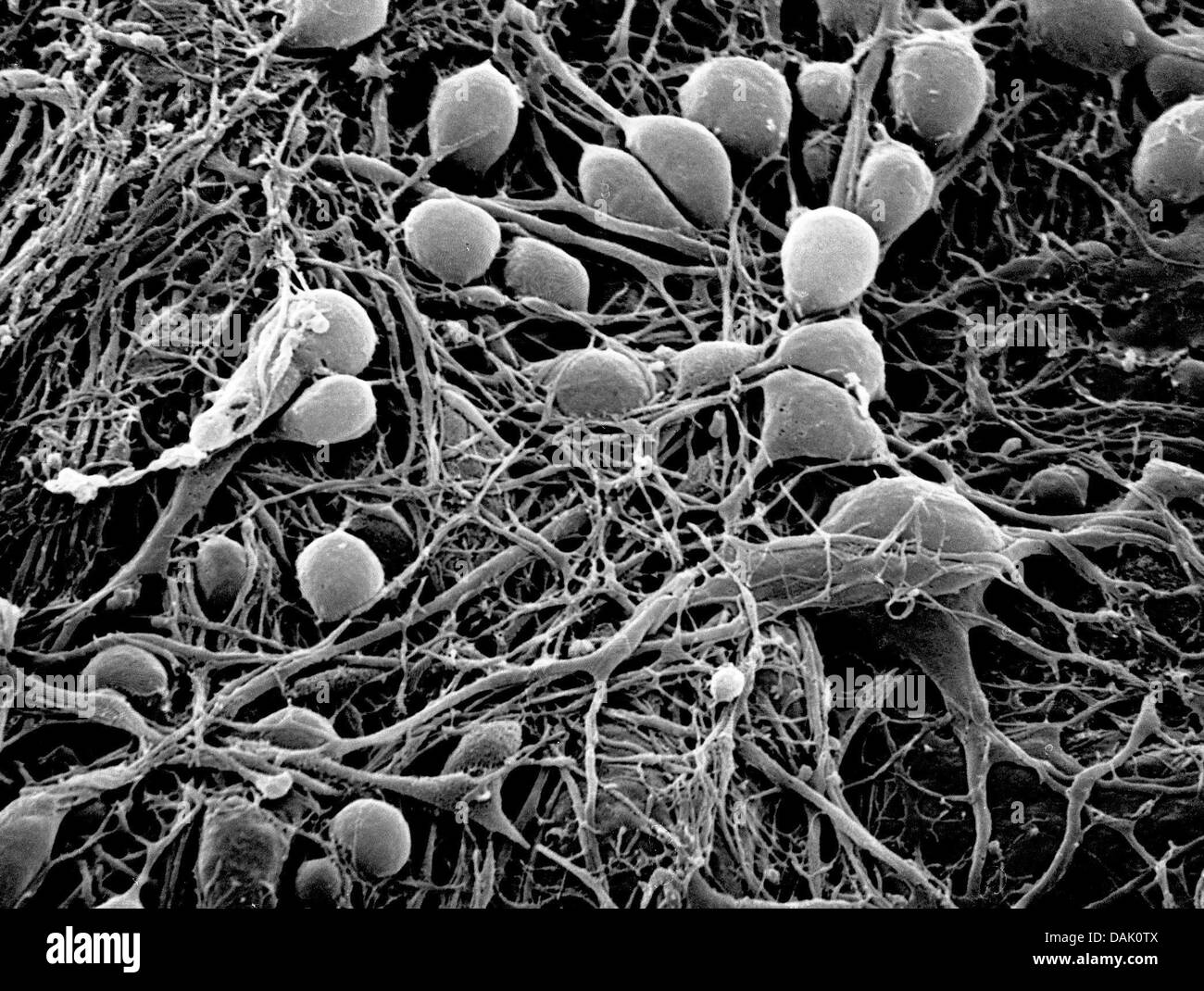 HANDOUT - An undated scanning electron microscope handout picture from the Max Planck Institute for Molecular Biomedicine shows human neurons grown from induced pluripotent stem cells in Muenster, Germany. Numerous scientists at the institute of the University of Muenster are involved in stem cell research. Photo: Mpi Muenster Stock Photo
