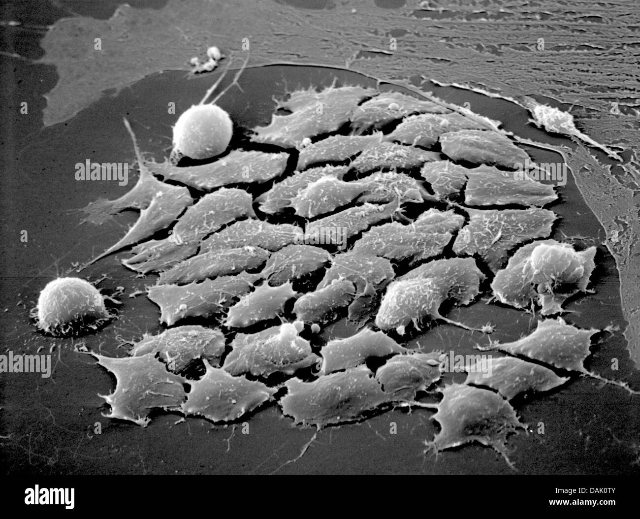 HANDOUT - An undated scanning electron microscope handout picture from the Max Planck Institute for Molecular Biomedicine shows embryonic stem cells of a mouse in Muenster, Germany. Numerous scientists at the institute of the University of Muenster are involved in stem cell research. Photo: Mpi Muenster Stock Photo