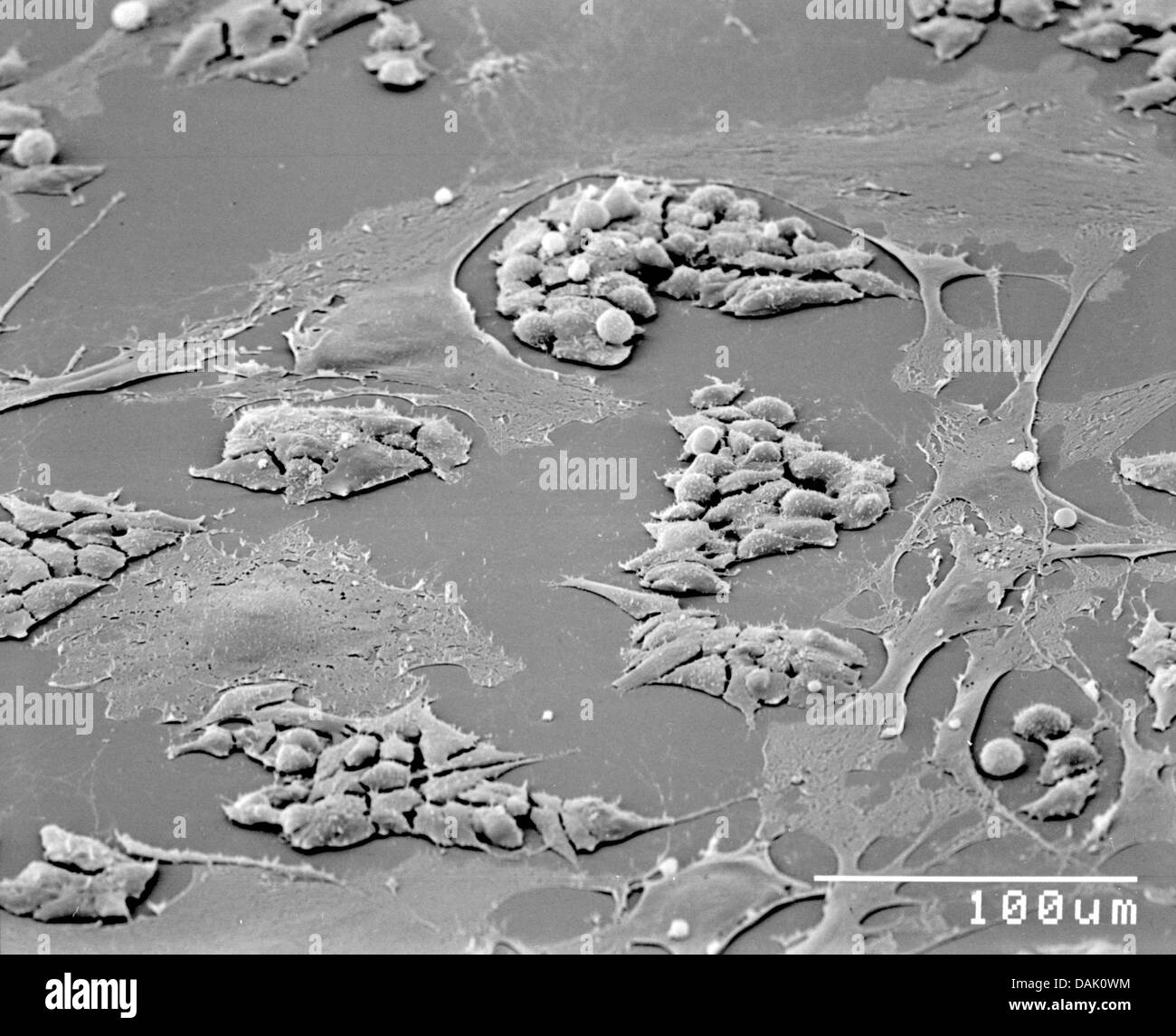 HANDOUT - An undated scanning electron microscope handout picture from the Max Planck Institute for Molecular Biomedicine shows embryonic stem cells of mice in Muenster, Germany. Numerous scientists at the institute of the University of Muenster are involved in stem cell research. Photo: Mpi Muenster Stock Photo