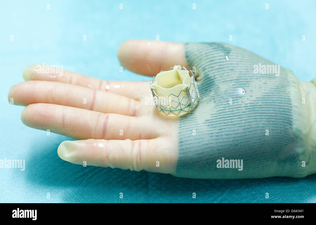 A biological cardiac valve lays in the hand of a surgeon at the Schuechtermann clinic in Bad Rothenfelde, Germany, 4 May 2011. The hospital specialized on heart disease and angiopathy. Photo: Friso Gentsch Stock Photo