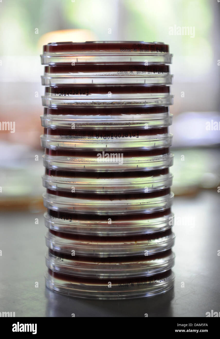 A stack of petri dishes with a speacial nutriant, upon which E. Coli bacteria strains can be seen, stands in a laboratory of the Hamburg Institute for Hygiene and Environment in Hamburg, Germany, 23 May 2011. On Monday, there are 90 suspected cases known of the hemorrhagic diarrhea infection connected with the E. Coli pathogen. Photo: CHRISTIAN CHARISIUS Stock Photo