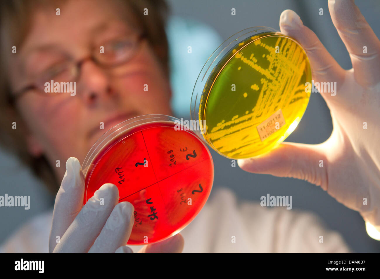 A laboratory worker compares EHEC colonies in petri dishes at the Robert  Koch Institute in Wernigerode, Germany, 27 May 2011. The EHEC wave is  rolling unabated mostly through North Germany. Up until