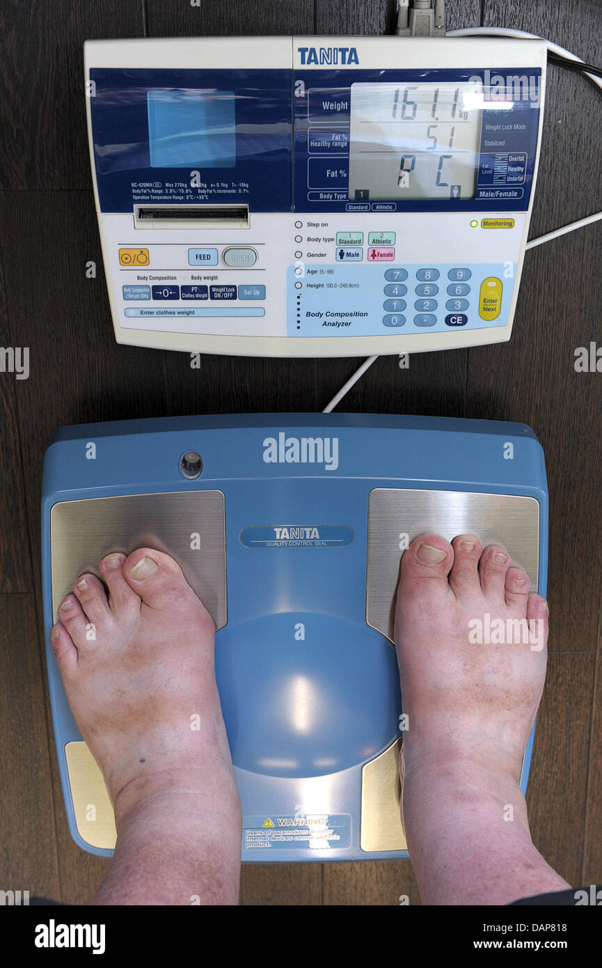 An obese patient stands on a special digital scale, which shows 161.1