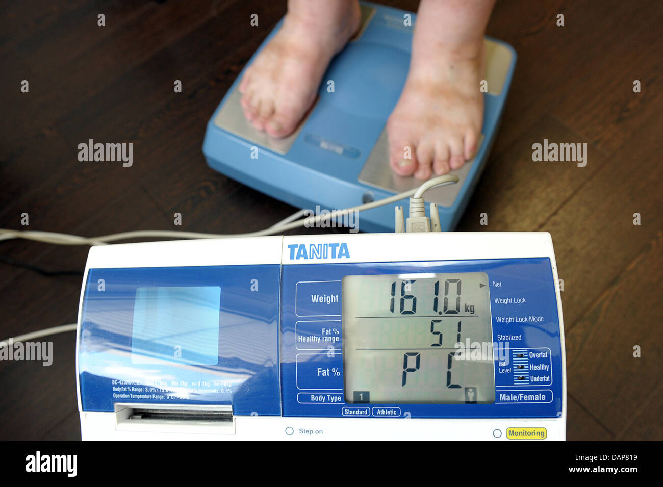 An obese patient stands on a special digital scale, which shows 161.1