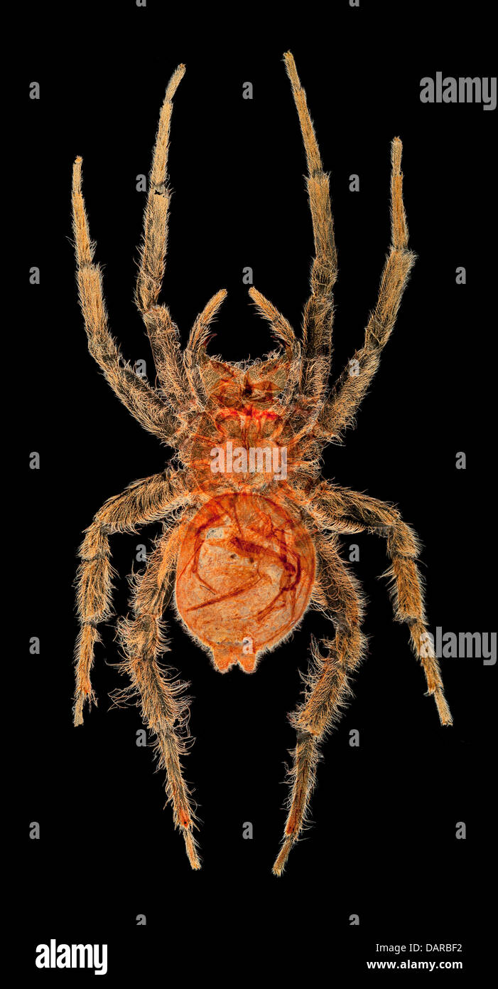 Darkfield photomicrograph, Argyroneta aquatica, Stock Photo